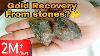 Stone Gold Recovery Gold Ore Gold Recovery Rocks Gold Recovery